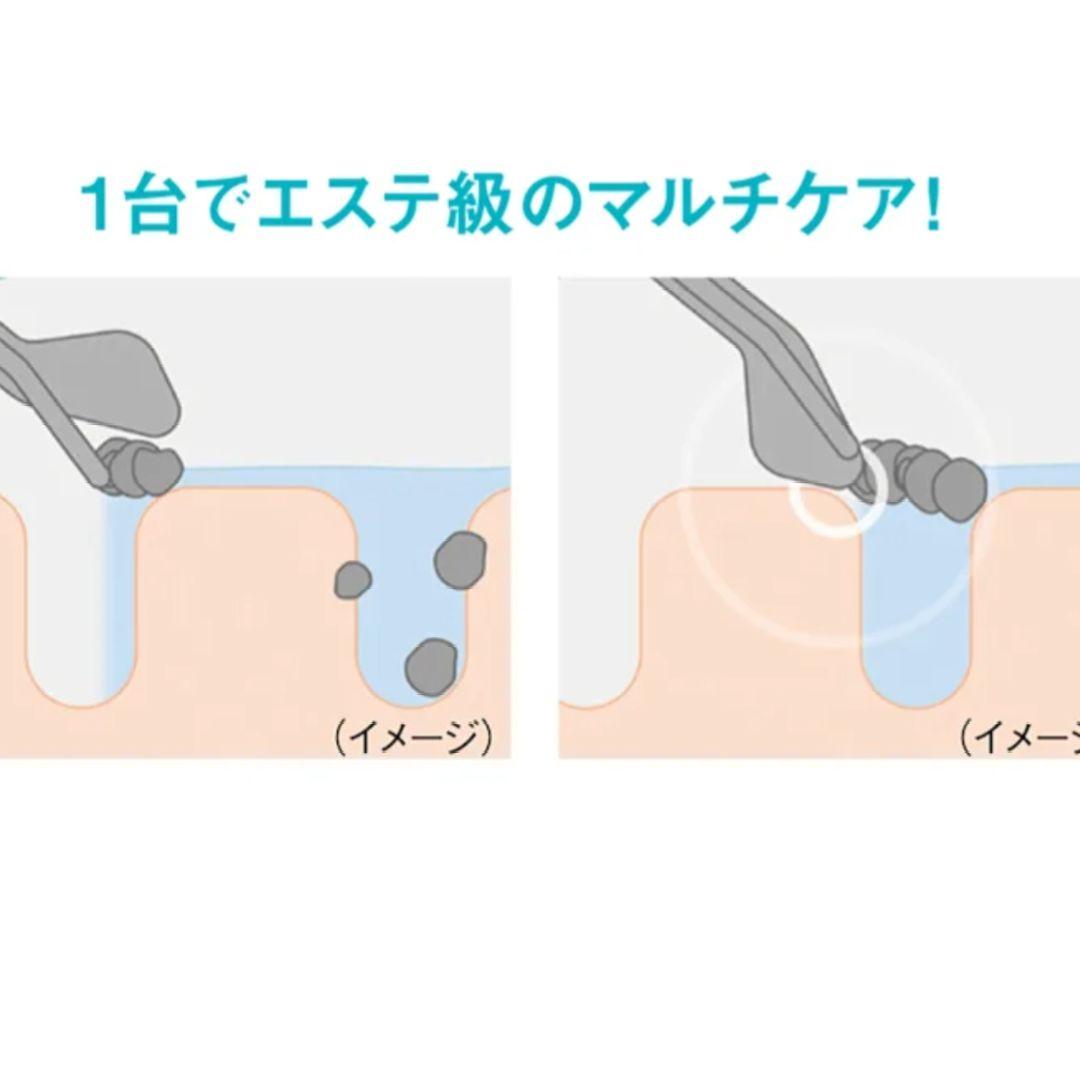 INGRACE アクアピールリフト毛穴ケア定価29800円❤新品未使用❤通電無